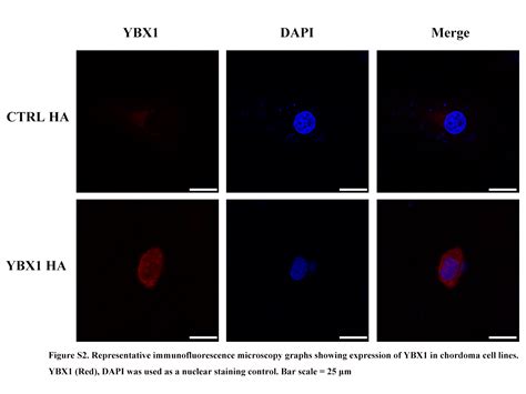 Y Box Binding Protein Promotes Tumorigenesis And Progression Via The