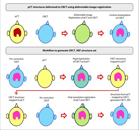 Figure 1 From Assessment Of Dosimetric Impact Of Interfractional 6d