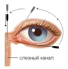 Непроходимость носо-слезного канала у ребенка: симптомы и лечение ...