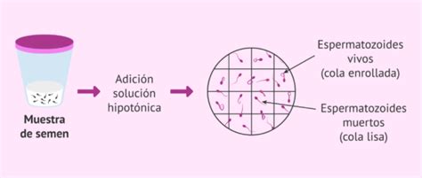 Prueba Hipoosmótica Para El Estudio De Fertilidad En El Varón