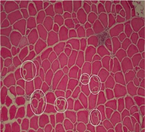 Image Of The Cross Section Of The Superficial Pectoral Muscle In Download Scientific Diagram