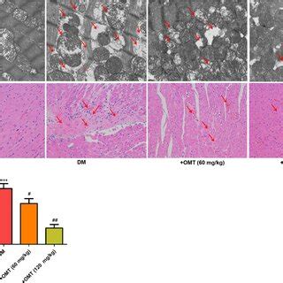 Effects Of OMT On The Histopathological Changes And Apoptosis In