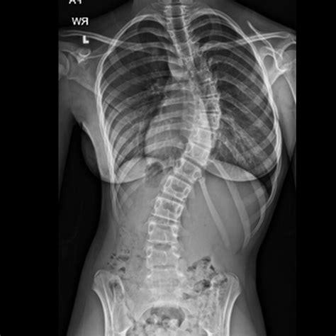 Try It Download This Random Image From The Web Or Use These Images From