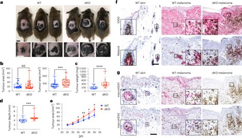 Macroh A Restricts Inflammatory Gene Expression In Melanoma Cancer