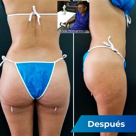 Fotografías Antes y Después Extracción Biopolímeros