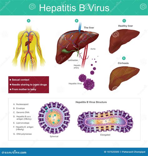 Virus De La Hepatitis B El Virus Es Transmitido Principalmente Por Estafa Sexual Ilustración Del