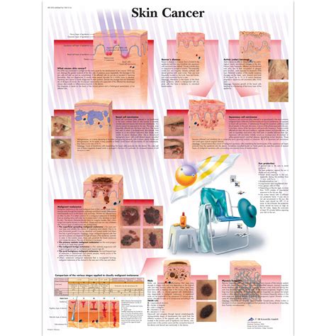 Anatomical Charts And Posters Anatomy Charts Pathology Charts Skin Cancer Laminated Chart