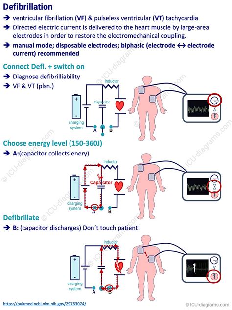 Defibrillation I Defibrillator