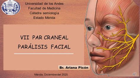 Vii Par Craneal Par Lisis Facial Semiolog A Youtube