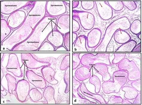 Photomicrographs Of Epididymis Sections From Normal Control A