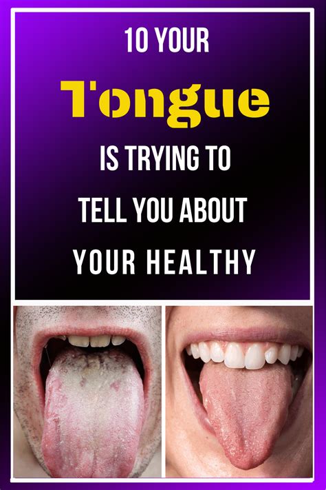 What Your Tongue Says About Your Health