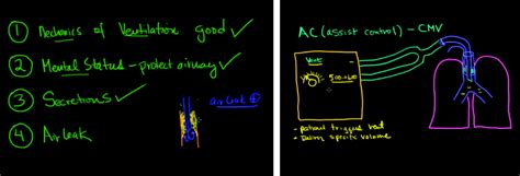 Mechanical Ventilation Made Easy Modes And Settings