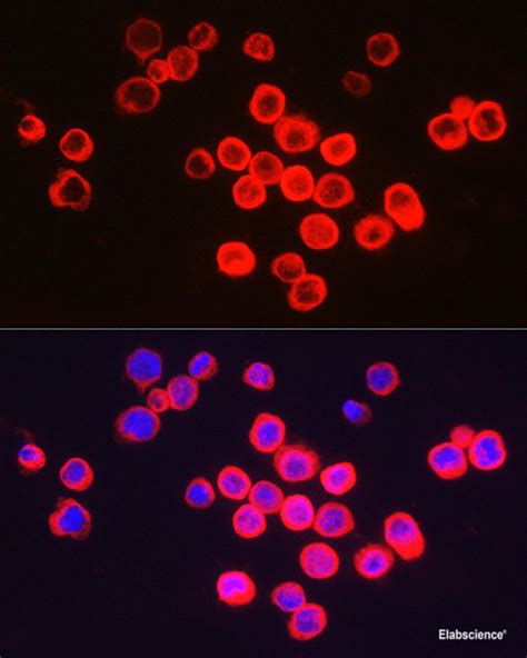 High Affinity And Specificity Bcl A Polyclonal Antibody E Ab At