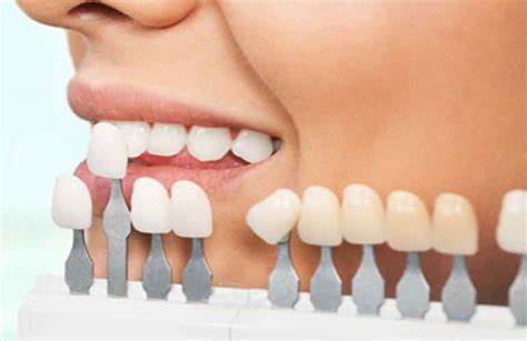 Implantes Dentales En Burgos