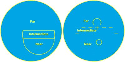 Trifocal Glasses and The Rest of Multifocal Lenses