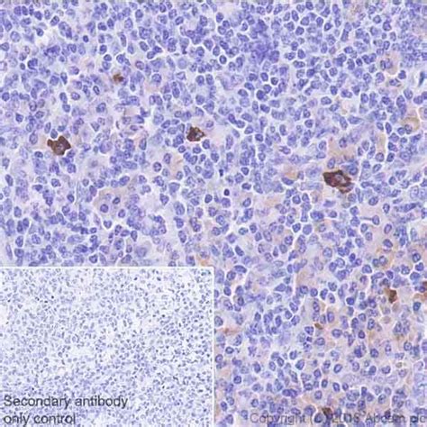 Anti-Interferon gamma antibody (ab25101) | Abcam
