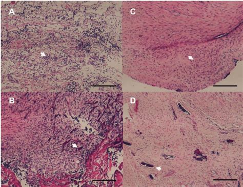 Histological Images Hematoxylin And Eosin Staining Of The