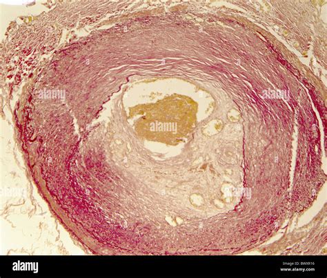 Vein Histology