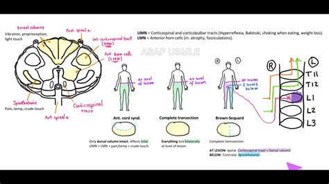 Spinothalamic Tract Physiopedia In 2021 Spinothalamic Tract | Hot Sex ...