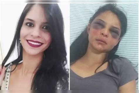 Mulher Fica Rosto Desfigurado Ap S Apanhar E Ficar H Amarrada