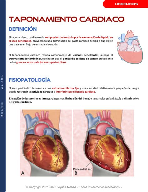 Diagrama De Taponamiento Cardiaco