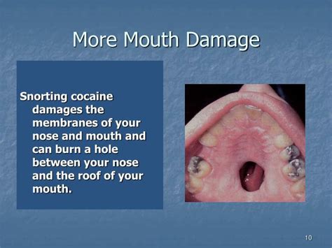 Coke Users Nose / PPT - Introduction PowerPoint Presentation - ID:5202493 / Is it okay if you ...