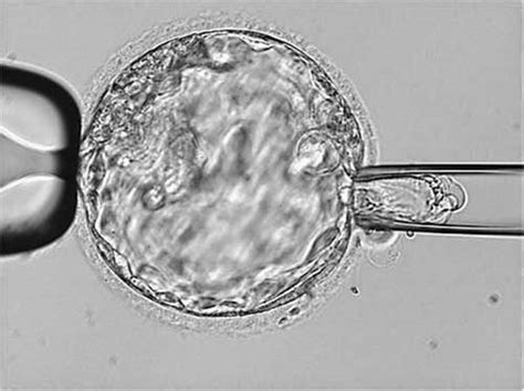 Pgs And Pgd The Embryo Genetic Testing Procedure The Ivf Specialist S Blog For Ivf Patients