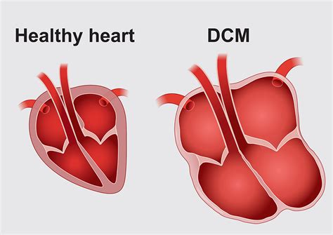 Dilated Cardiomyopathy Wellness Veterinary Hospital