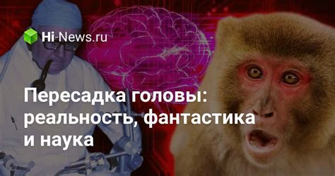 Пересадка головы: реальность, фантастика и наука - Hi-News.ru