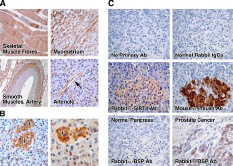 Sirt Is Expressed In Skeletal And Smooth Muscle Cells And In