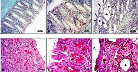 Photomicrographs Of Colon Sections Stained With Massons Trichrome A