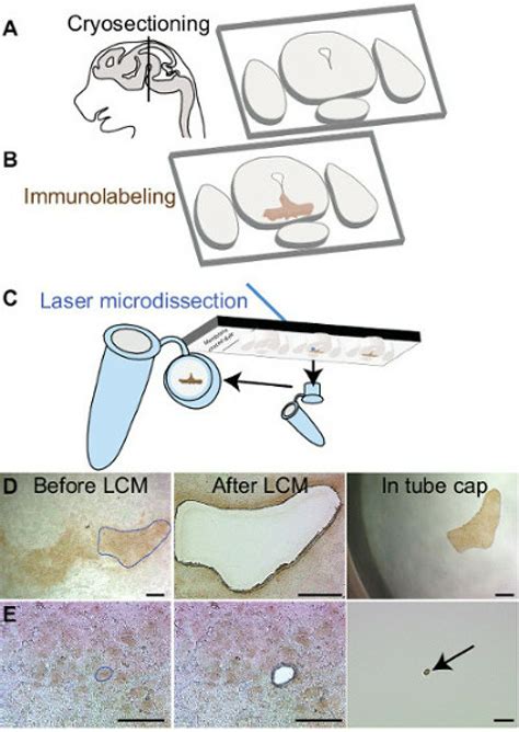 Rapid immunolabeling and laser capture microdissection procedure . ( A ... 