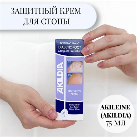 Защитный крем Акилдиа (AkilDia) - купить с доставкой по выгодным ценам ...