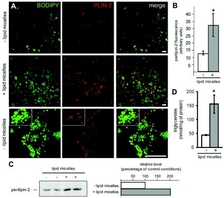 Caco-2/TC7 cells were cultured for 3 weeks on semi-permeable filters ...