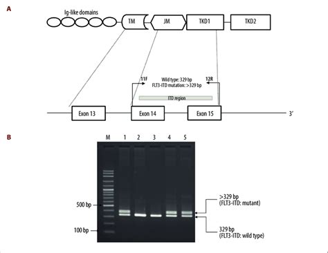 Identification Of Fms Like Tyrosine Kinase Flt Internal Tandem