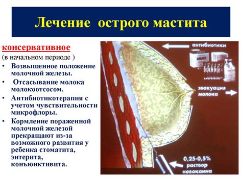 Заболевания молочной железы - презентация онлайн
