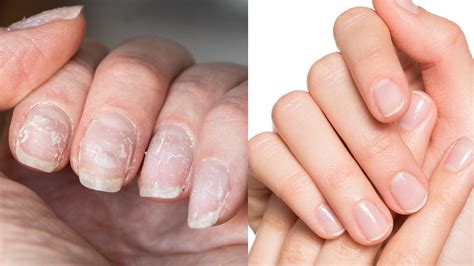 Nails Slugging Uratuje Nawet Najbardziej Zniszczone Paznokcie Po Hybrydzie