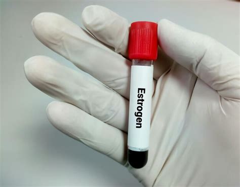 Premium Photo | Blood sample for estrogen or estradiol hormone test