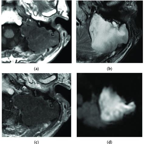 Flowchart For Middle Ear Tumors Download Scientific Diagram