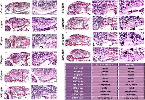 Microscopic Image Of Hematoxylin And Eosin Staining H And E Of