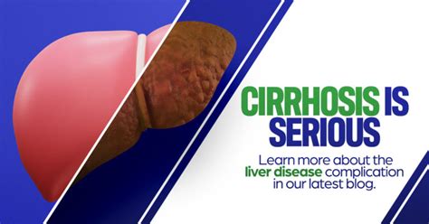 The Consequences Of Cirrhosis Clinical Pharmacology Of Miami