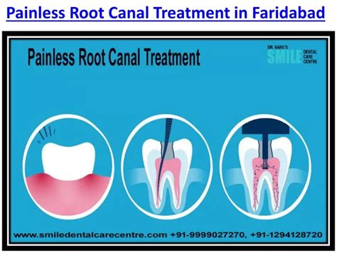 Ppt Orthodontic Dental Clinic For Advanced Aligner Braces Treatment