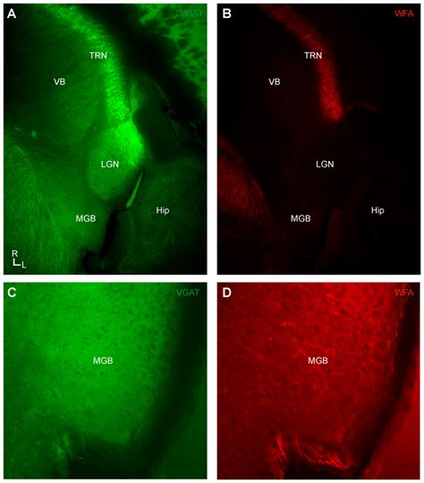 Wisteria Floribunda Agglutinin Labeled Perineuronal Nets In The Mouse