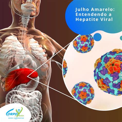 Hepatite Deixa A Pessoa Amarela - Julho Amarelo: Entendendo a Hepatite Viral - Corpo em Ação