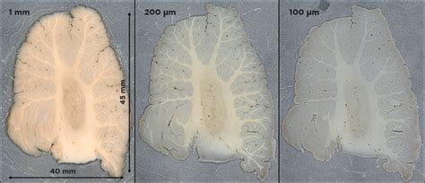 Microtome Types and Applications