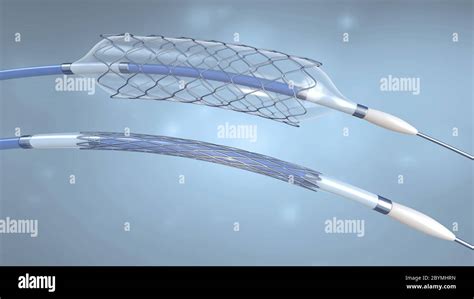 Stent And Catheter For Implantation Into Blood Vessels With An Empty