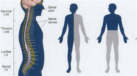 Difference Between Flaccid and Spastic Paralysis - YouTube