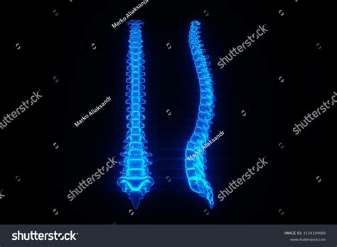 Medical Poster Anatomy Human Spine Image Stock Illustration 2124104060