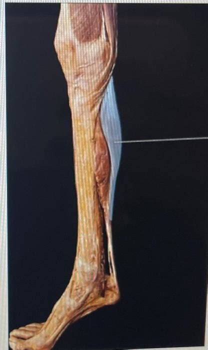 Solved Identify The Highlighted Muscles Chegg