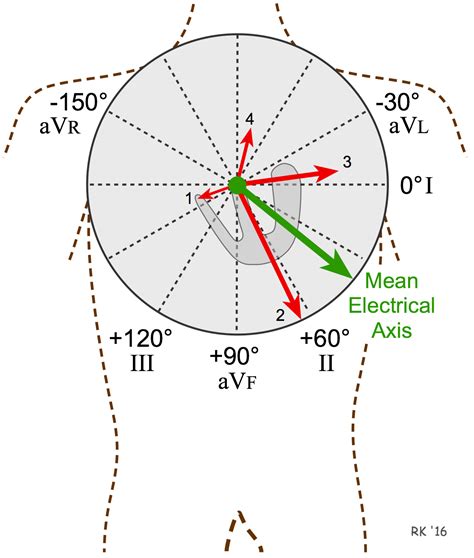 Cv Physiology Ventricular Depolarization And The Mean Electrical Axis